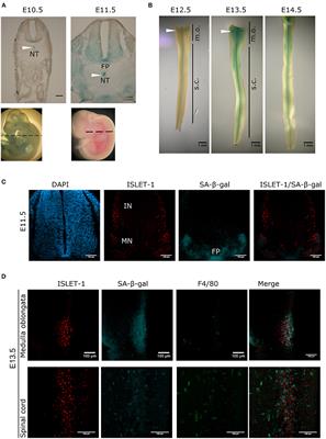 Programmed Cell Senescence in the Mouse Developing Spinal Cord and Notochord